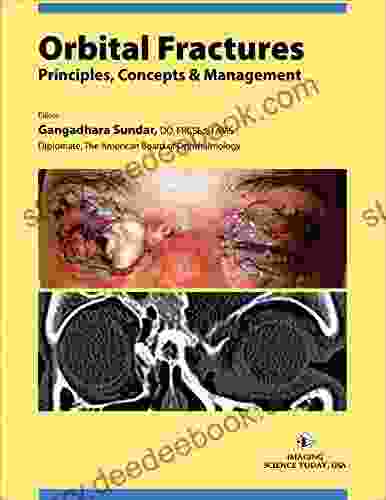 Orbital Fractures: Principles Concepts Managements